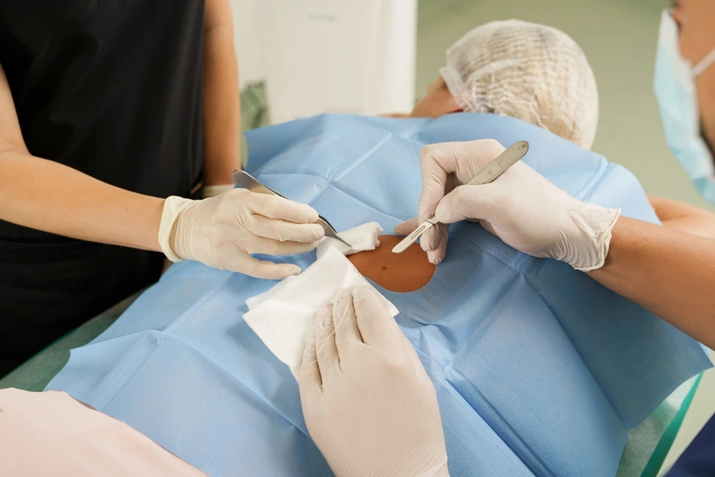 Dermato Surgery